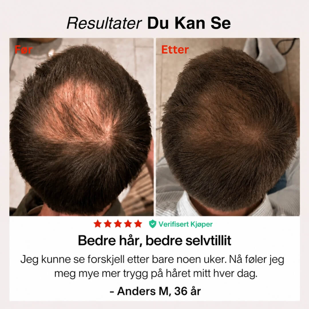 Rødlys-Capsen