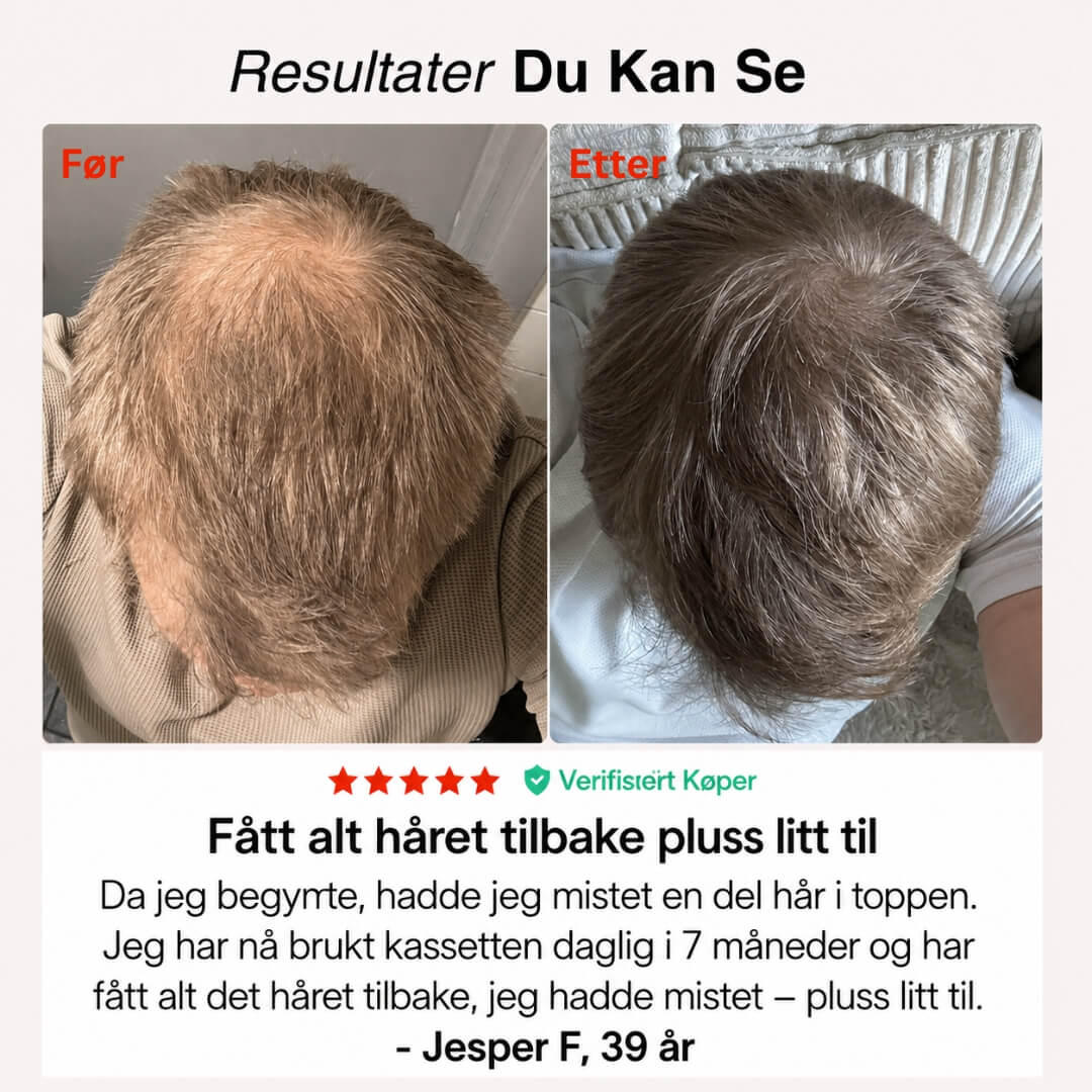 Rødlys-Capsen