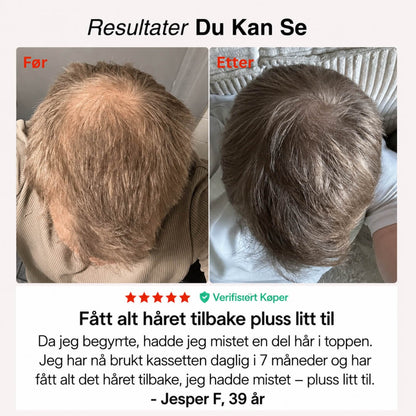 Rødlys-Capsen