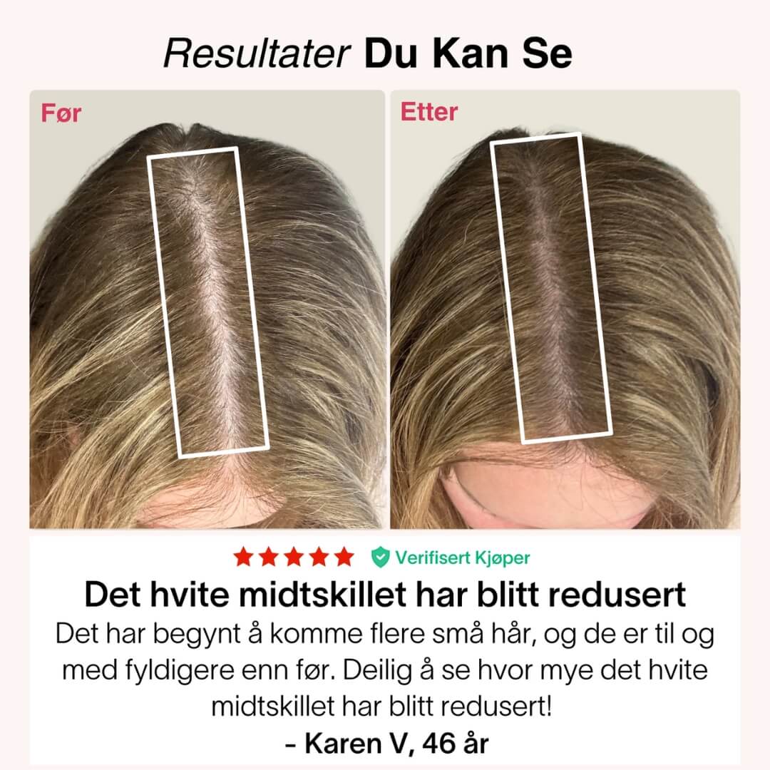 Rødlys-Capsen